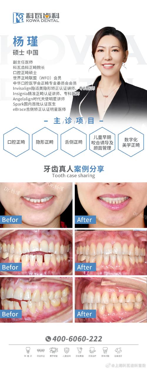 上海矫正牙齿去哪儿好？医院口碑与医生技术怎么选？-图2