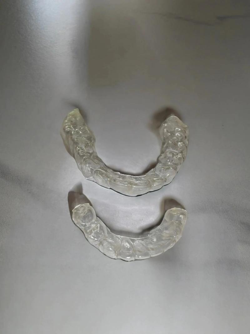 牙齿矫正保持器哪种好-图2