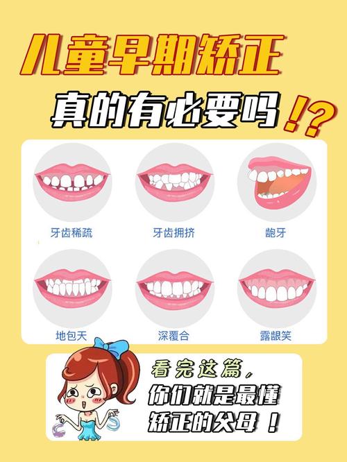 牙齿矫正最快的方法是什么？哪种更安全高效？-图2