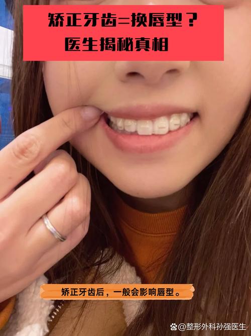 矫正牙齿真的会让嘴唇变厚吗？矫正后嘴唇厚度会有变化吗？-图2