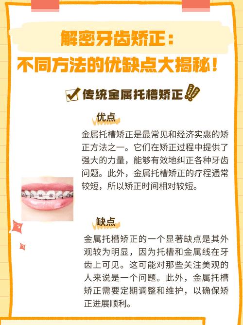 37岁矫正牙齿优缺点-图3