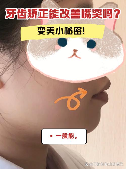 矫正牙齿会影响唇形吗？改变程度如何？-图1