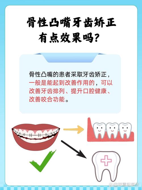 牙齿骨性突出怎么矫正？有哪些有效方法？-图2