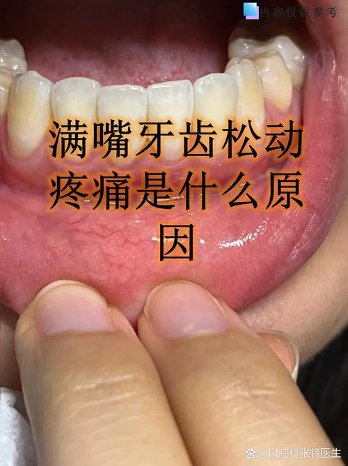 矫正牙齿会导致牙敏感吗？真相原来是这样-图2