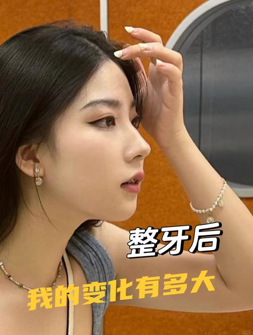 24岁矫正牙齿还来得及吗？成年人做矫正晚不晚？-图2