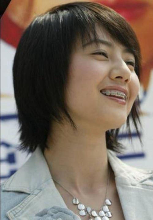 高圆圆矫正牙齿前图片曝光，牙齿状态究竟如何？-图1