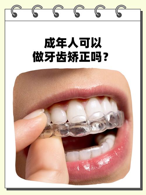 成人矫正牙齿有必要吗-图1