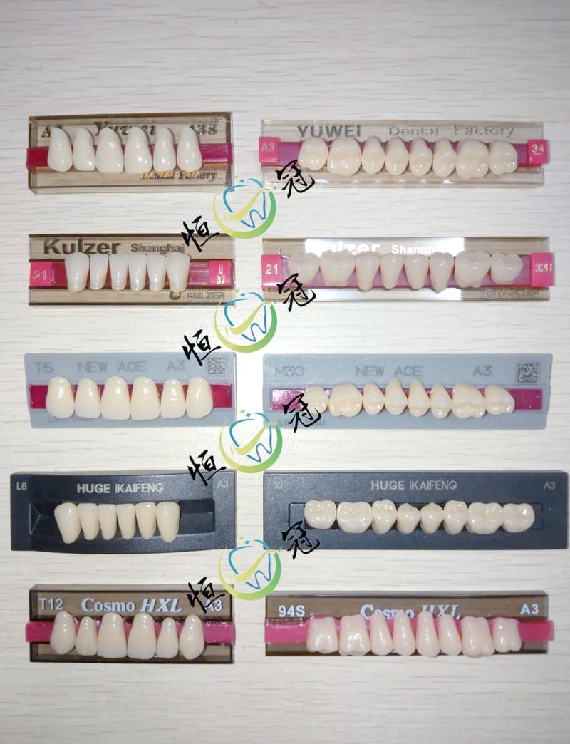 矫正牙齿的材料有哪些？不同材料有何区别与应用？-图1