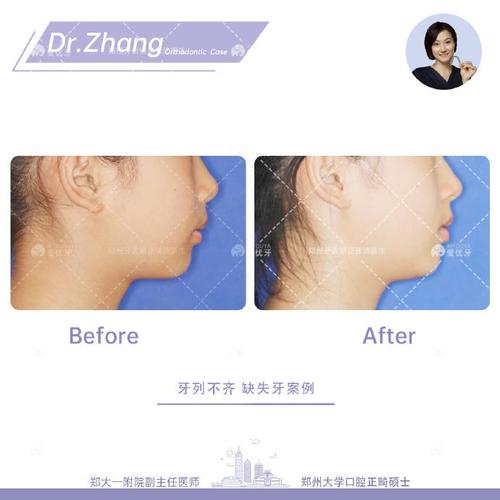 郑州矫正牙齿哪家好？求推荐靠谱的医院和医生！-图1