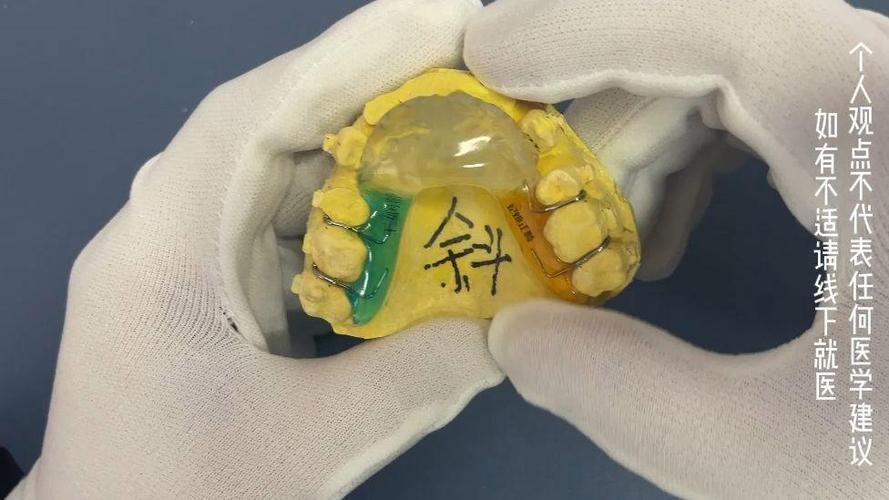 戴牙齿矫正导板说话会受影响吗？-图1