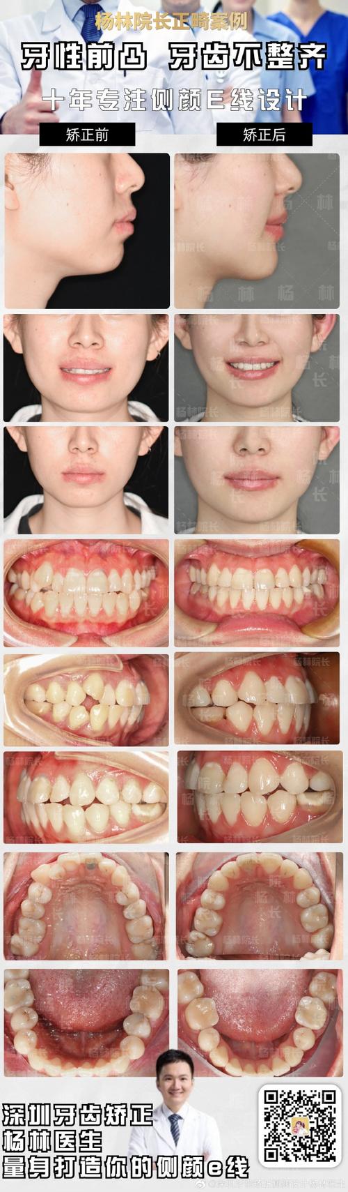 深圳牙齿矫正哪家最好？如何选到靠谱又专业的机构？-图1