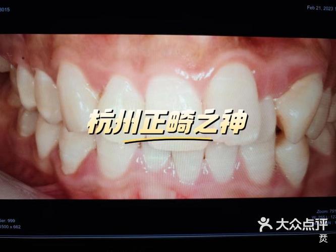 杭州牙齿矫正哪家更靠谱？-图2