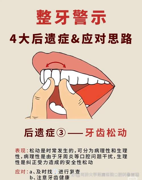 牙齿矫正真的会对牙齿造成伤害吗？-图1