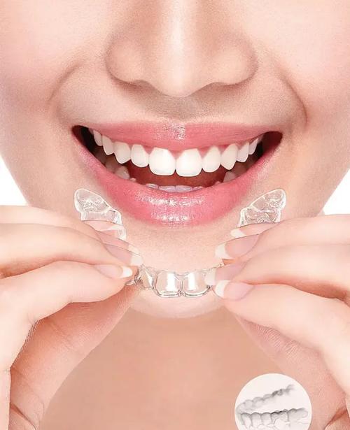 珠海口腔医院牙齿矫正，效果、价格和医生选择怎么样？-图1