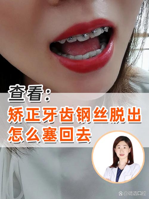 矫正后牙齿变形了，该如何有效解决？-图1