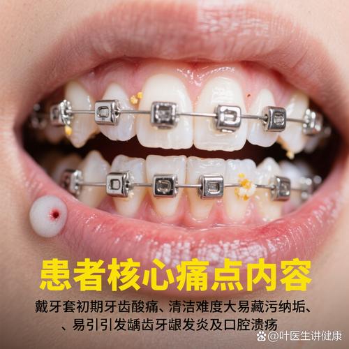 有坏牙可以矫正牙齿吗？-图1