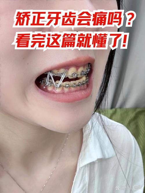 牙齿矫正后牙龈会红肿萎缩吗？这些变化正常吗？-图1