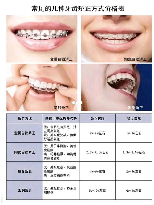 秦皇岛矫正牙齿大概要花多少钱呢？-图3