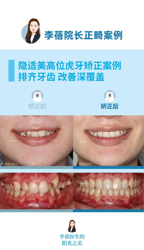 广州矫正牙齿去哪里好-图2