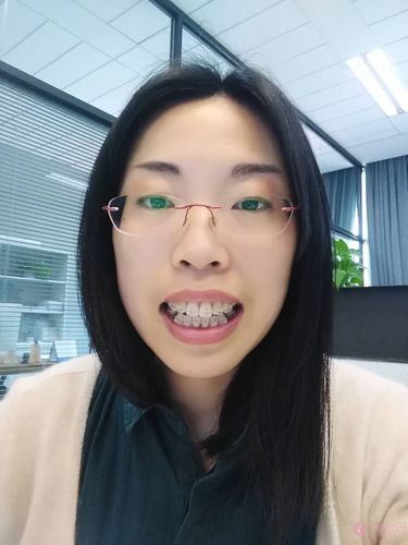 常州口腔医院矫正牙齿效果好不好？价格透明吗？值得选吗？-图1