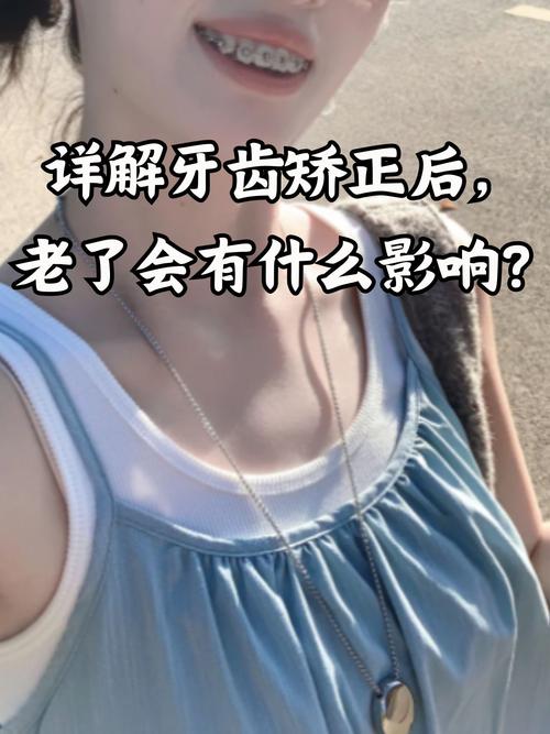 孕期牙齿矫正会影响母婴健康吗？-图3