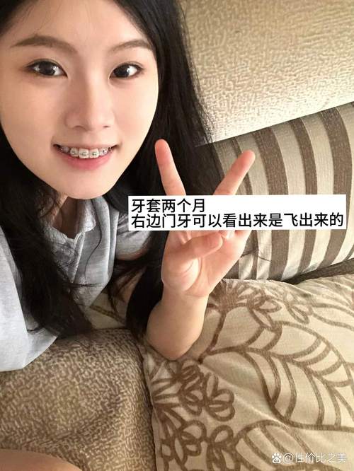 34岁矫正牙齿还来得及吗?-图3 34岁矫正牙齿还来得及吗?-图3