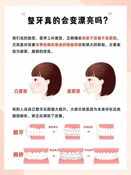 矫正牙齿真的能改变脸型吗?-图1 矫正牙齿真的能改变脸型吗?-图1