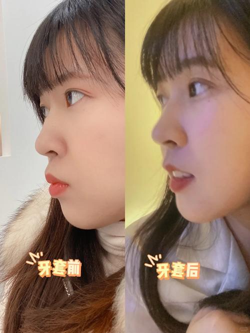 长沙牙齿矫正哪里好？专业医院/诊所怎么挑？效果价格都靠谱吗？-图1