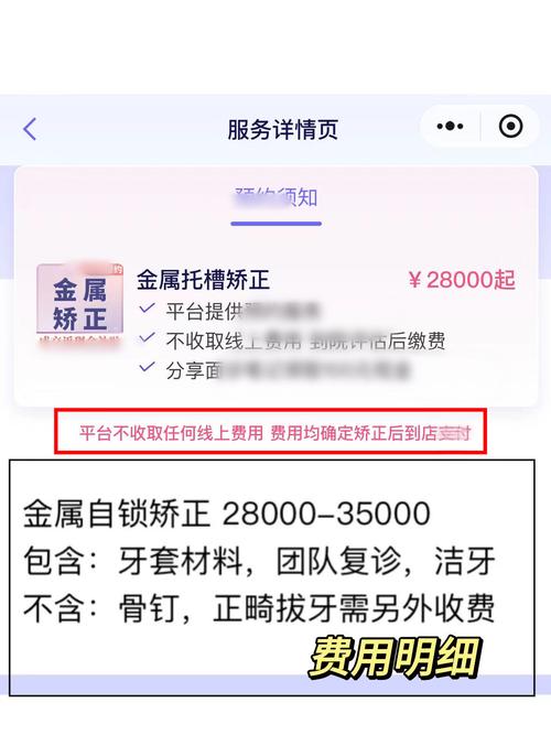 上海矫正牙齿到底要花多少钱？-图3