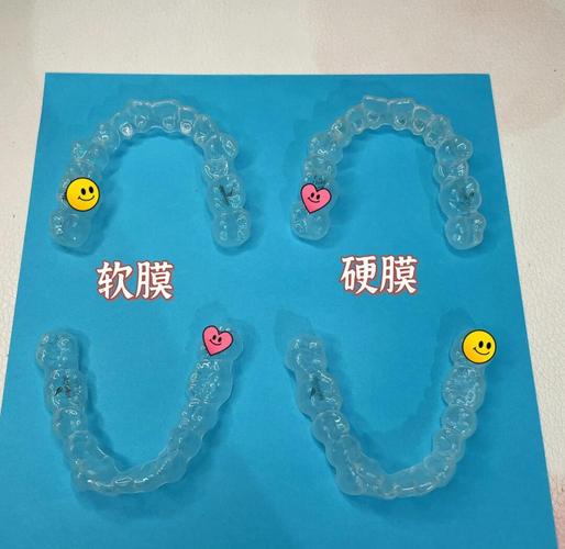 时代天使矫正牙齿效果-图1