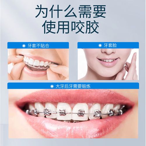 时代天使隐形矫正效果如何？与传统矫正比优势在哪？-图2