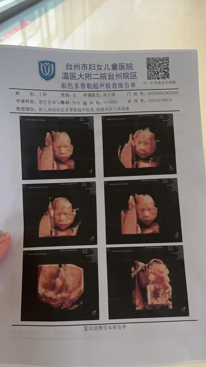 矫正一年后怀孕，牙齿矫正还能继续吗？-图3