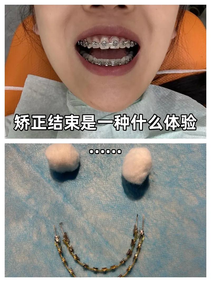 矫正一年后怀孕，牙齿矫正还能继续吗？-图2