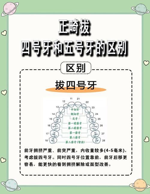 牙齿矫正通常要拔几颗牙？-图1