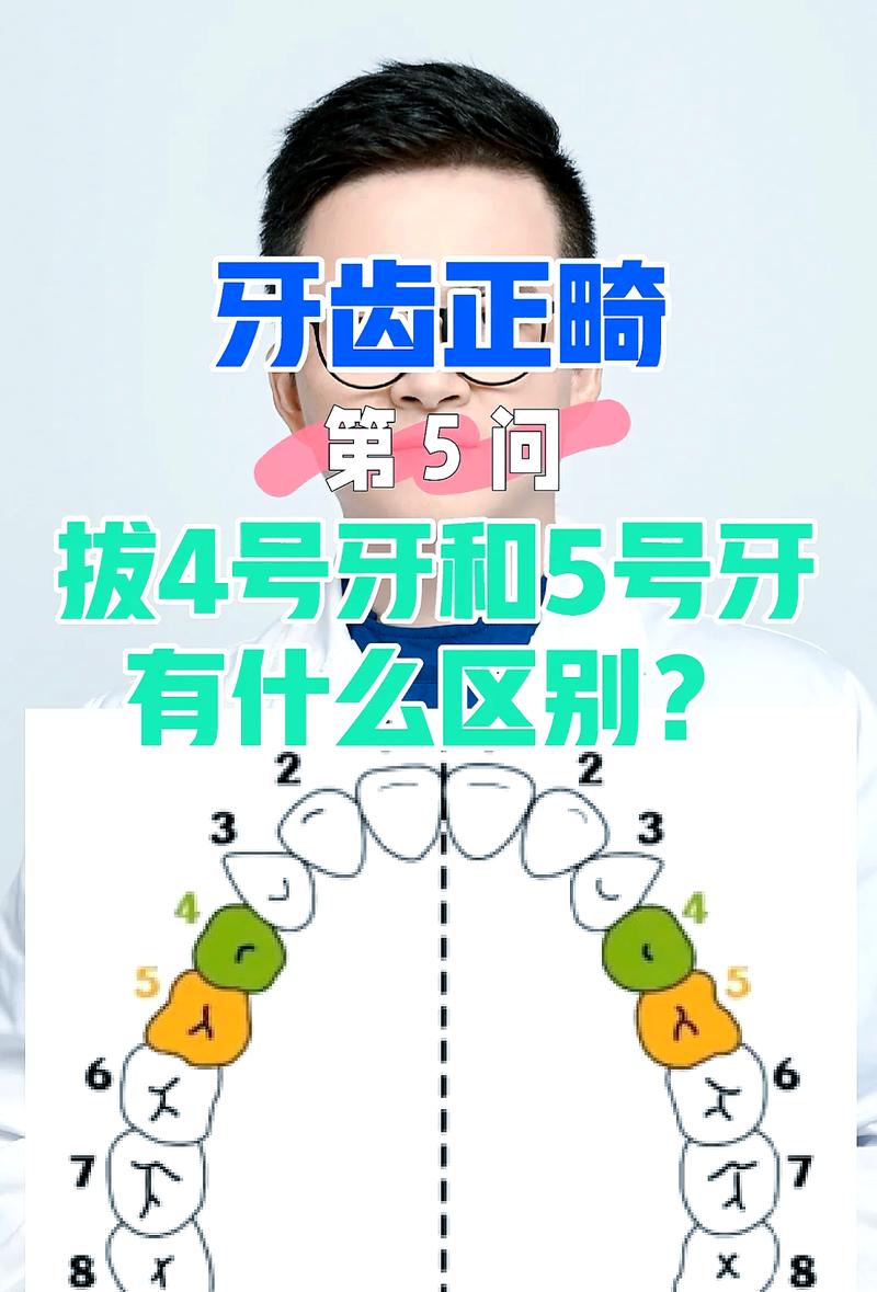 矫正牙齿一般拔几颗牙？数量因人而异还是固定标准？-图1