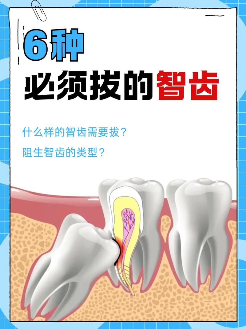 牙齿矫正能拔智齿吗？-图2