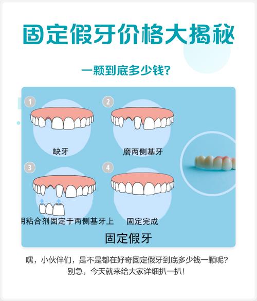 隐形矫正器费用为何差异大？关键影响因素有哪些？-图2