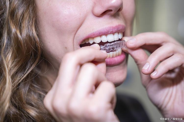 隐形矫正效果好不好？牙齿矫正靠谱吗？-图2