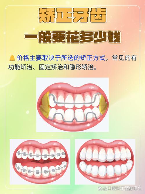 成人牙齿矫正费用多少？不同情况价格差异有多大？-图3