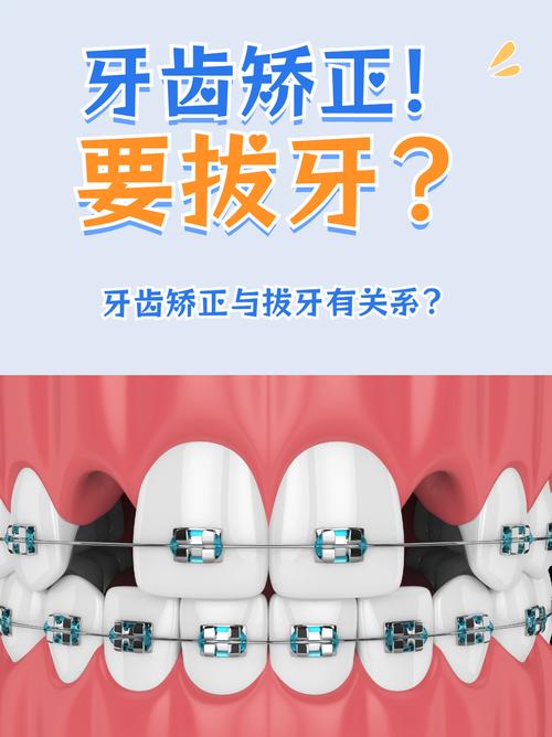 矫正牙齿时，医生为何建议拔牙？-图1