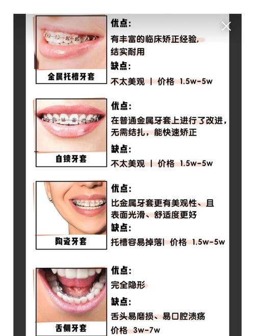 26岁矫正牙齿费用多少？成人矫正价格受哪些因素影响？-图3