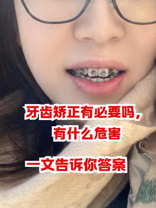 矫正牙齿可以不戴牙套吗？-图1