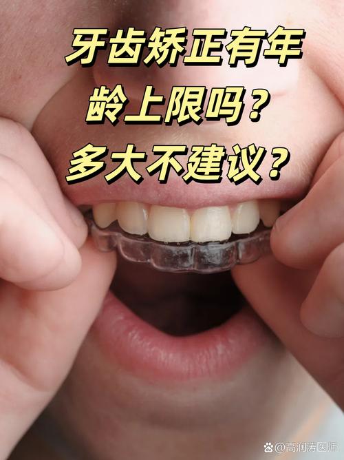 矫正牙齿可以不戴牙套吗？-图2