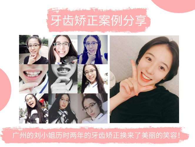 广州牙齿矫正哪家医院好?求靠谱推荐-图1 广州牙齿矫正哪家医院好?求靠谱推荐-图1