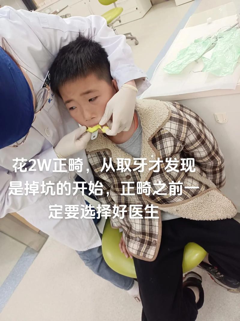 武汉大学口腔矫正牙齿效果怎么样？-图1