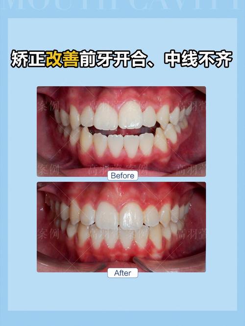 北京矫正牙齿哪里好？专业机构怎么选？-图2