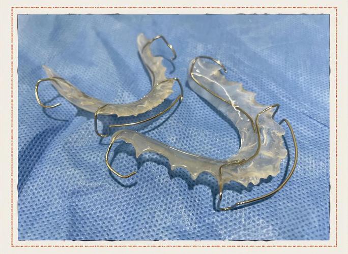 牙齿矫正保持器图片有哪些类型？不同矫正方式图片有何区别？-图2