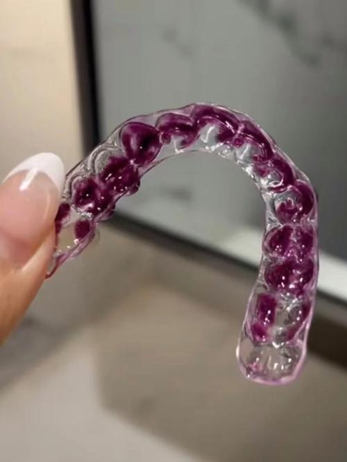 牙齿矫正保持器图片有哪些类型？不同矫正方式图片有何区别？-图3