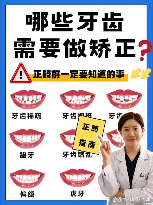 牙齿是否需要矫正?关键信号在此-图1 牙齿是否需要矫正?关键信号在此-图1