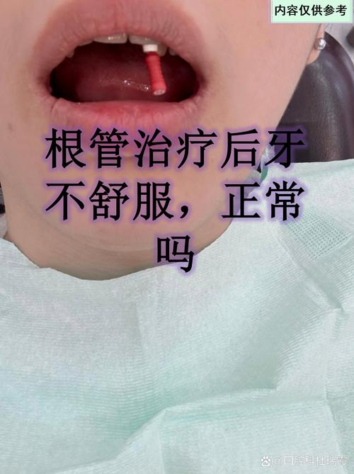 根管治疗后能矫正牙齿吗？时机要注意什么？-图3